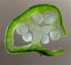  Ovary T. S.  from base